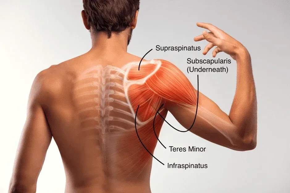 Rotator Cuff Tendinitis