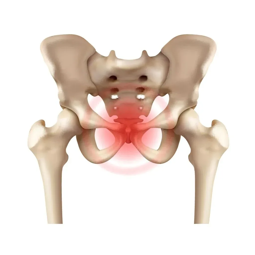 Symphysis pubis dysfunction (SPD)